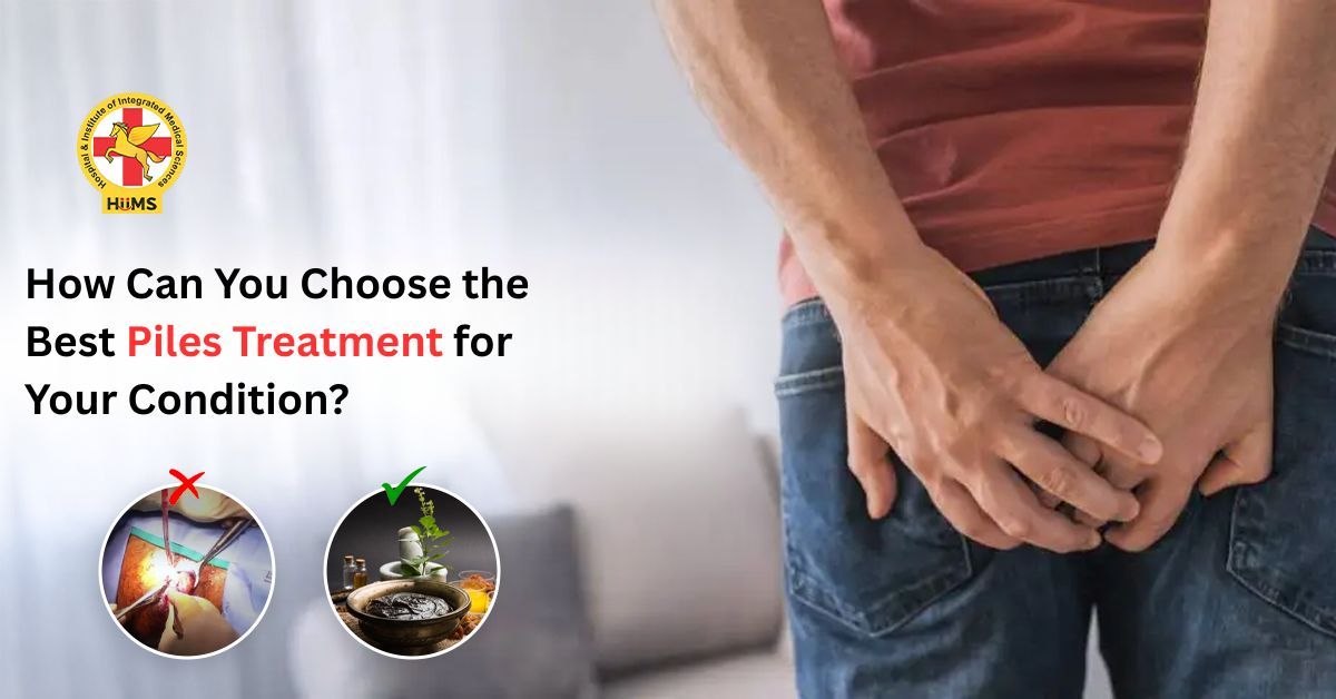 How Can You Choose the Best Piles Treatment for Your Condition?