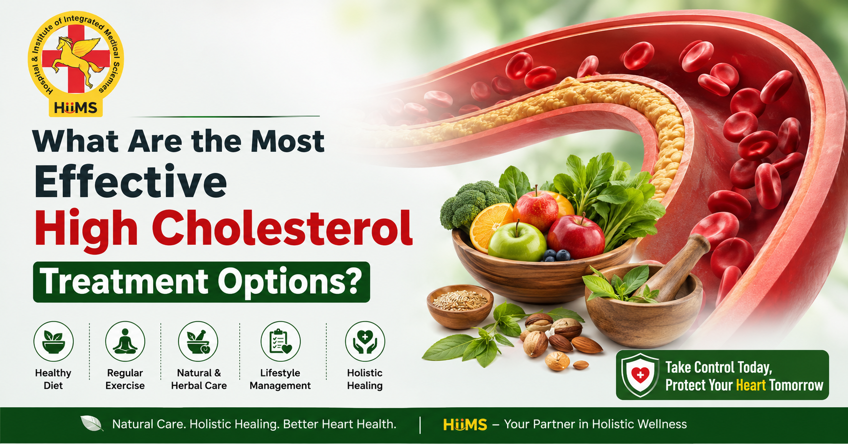 What Are the Most Effective High Cholesterol Treatment Options