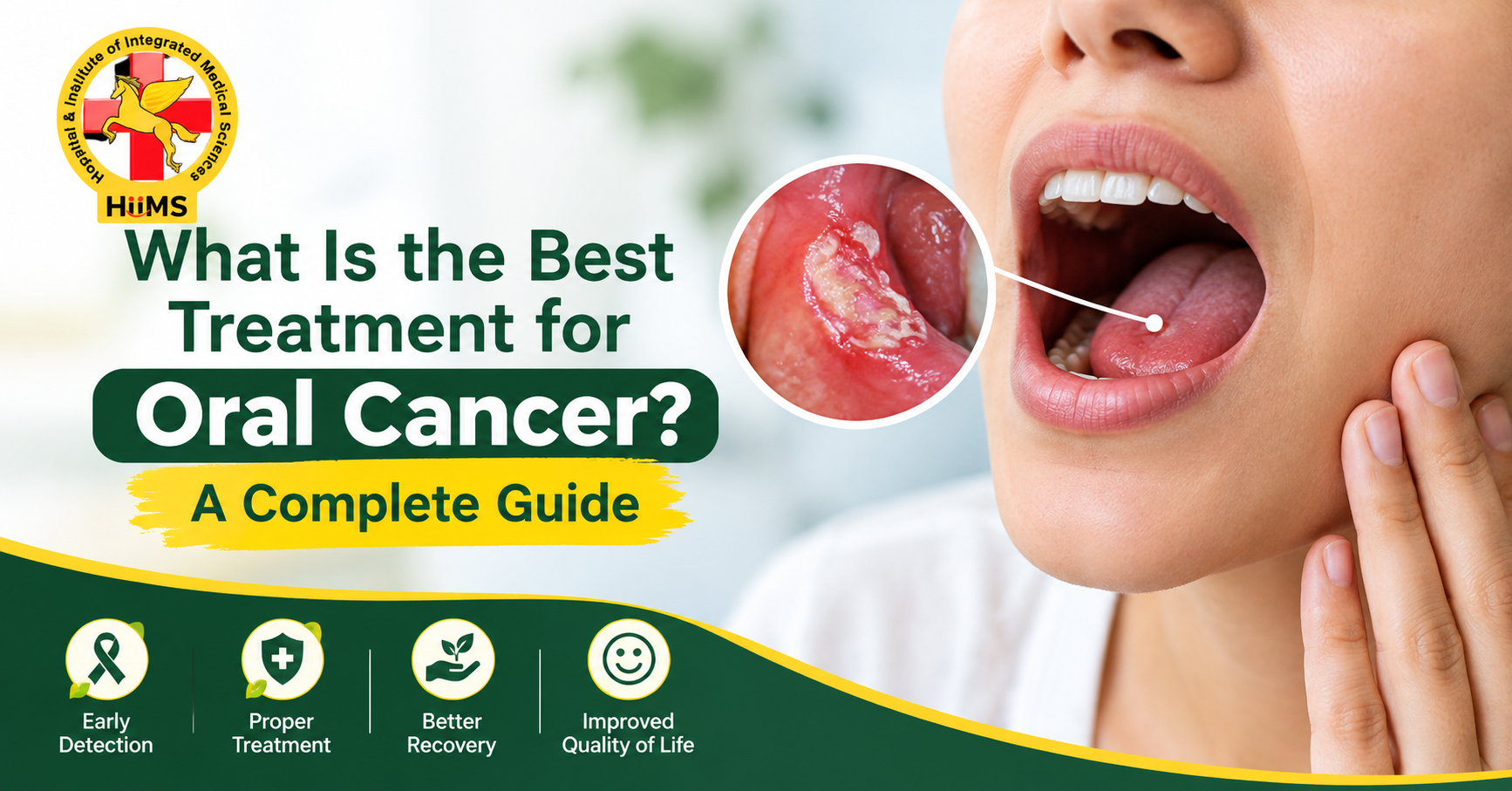 What Is the Best Treatment for Oral Cancer? A Complete Guide