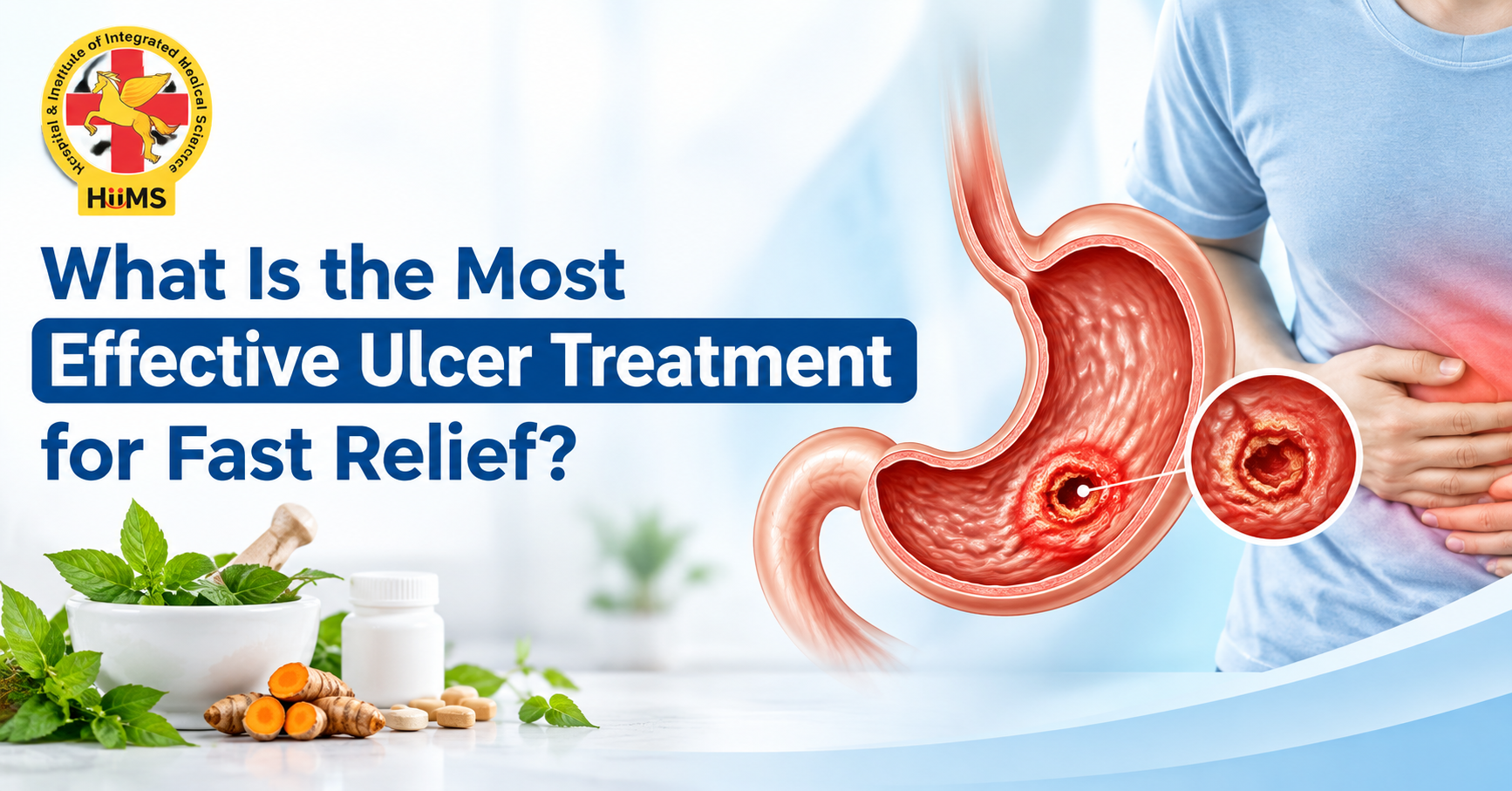 What Is the Most Effective Ulcer Treatment for Fast Relief?